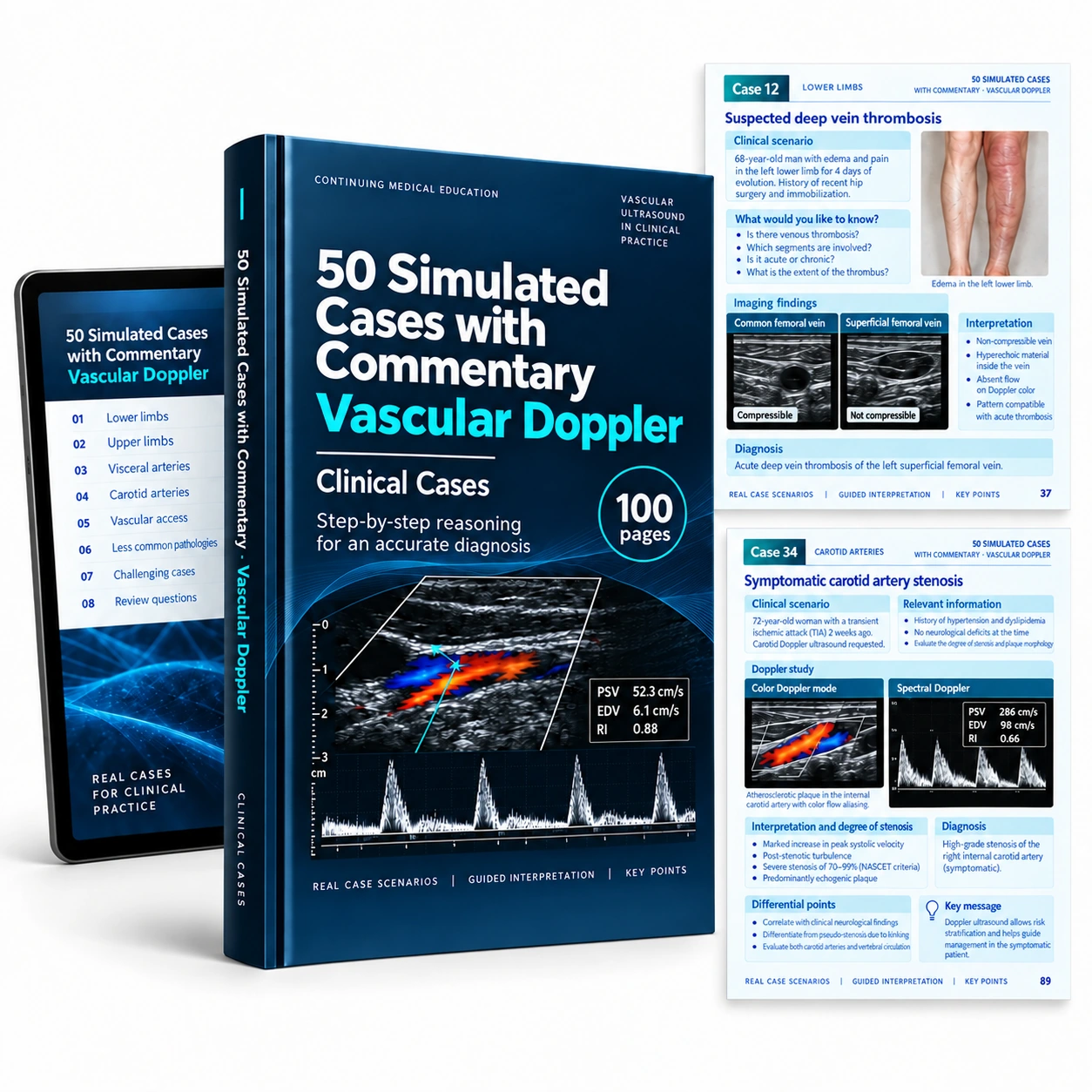 Digital mockup: 50 Simulated Cases with Commentary — Vascular Doppler