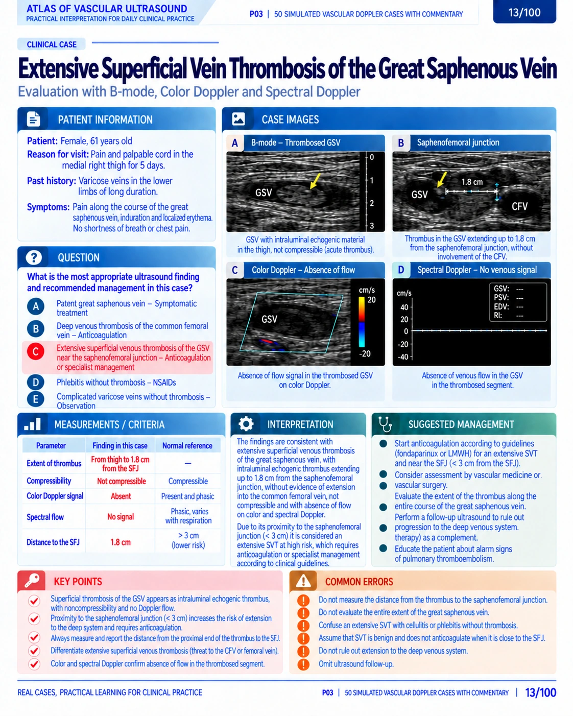 Page 13: Case: superficial venous thrombosis. English preview of the digital vascular Doppler material.
